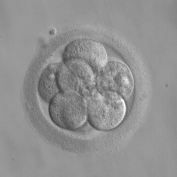 embryo trasnfer